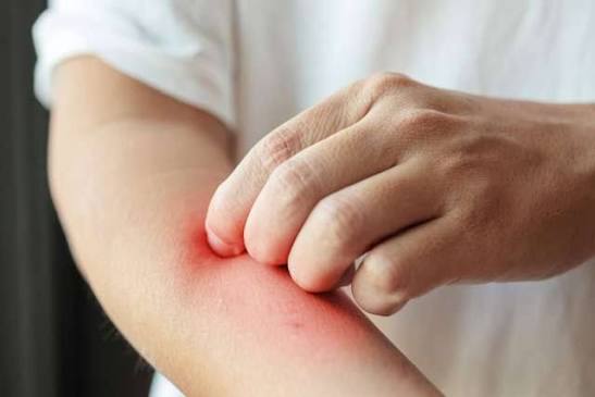 skin allergy, itching & rashes